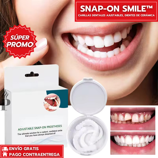 SnapOn Fix Smile™: Carillas Dentales Ajustables - Dientes de Cerámica